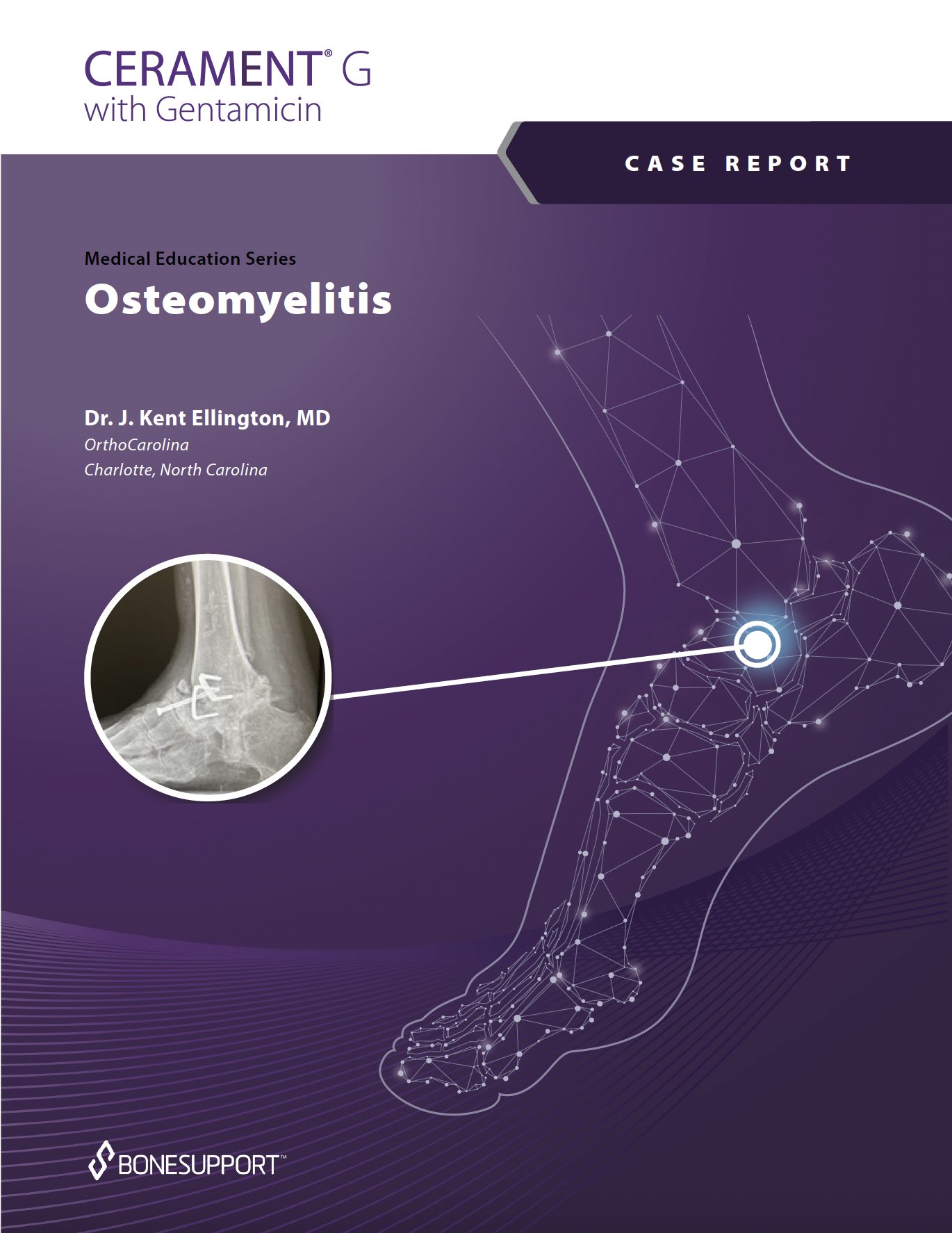 Osteomyelitis Dr. Ellington